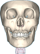 Virtual Patient